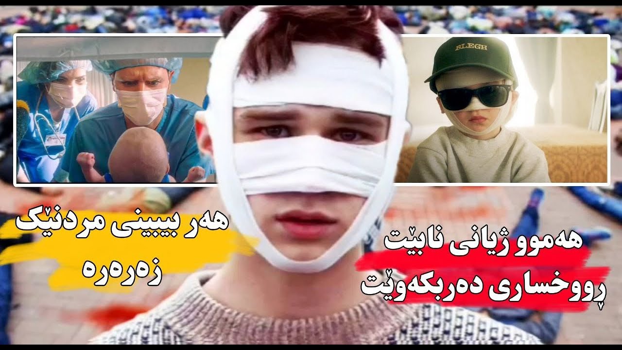 منداڵێك ئەوەنە بەجوانی لەدایك ئەبێت كە هەركەسێك سەیری بكات یەكسەر ئەمرێت
