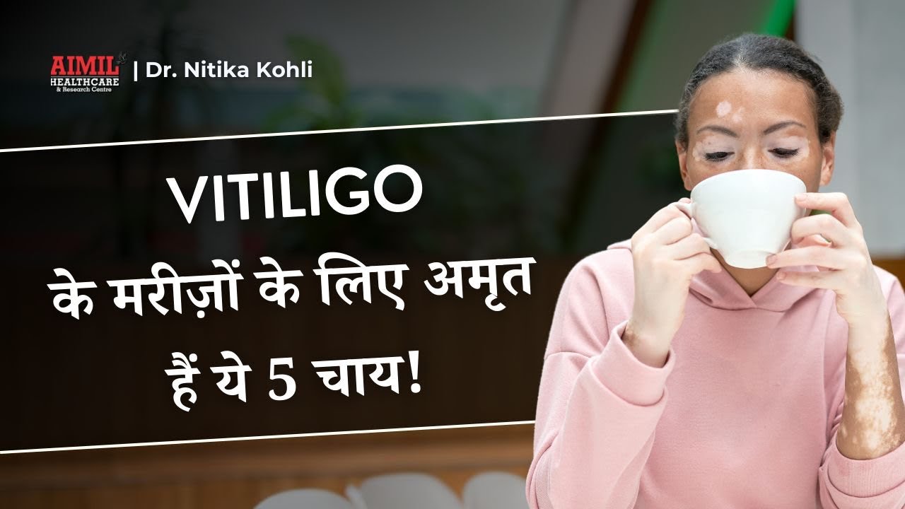 5 Teas For Vitiligo Recovery & Good Health | Dr. Nitika Kohli