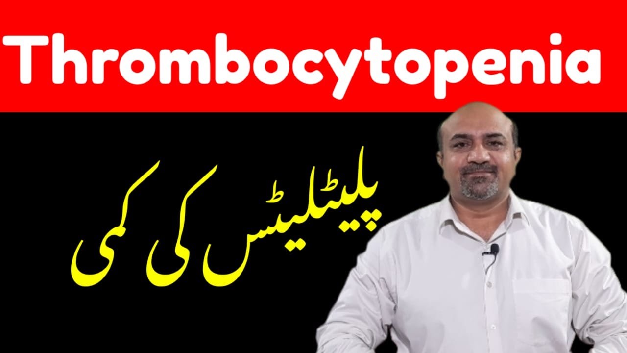Thrombocytopenia in Urdu | Thrombocytopenia Kya Hota Hai | Thrombocytopenia Treatment | Causes
