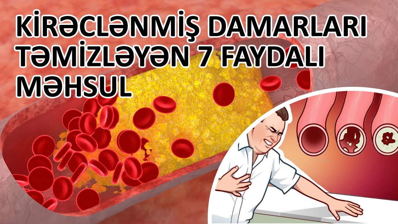 Kirəclənmiş damarları təmizləyən 7 faydalı məhsul