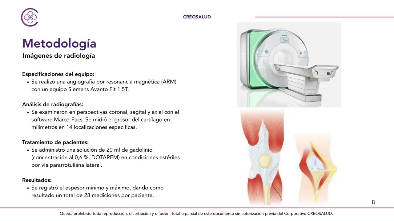 Aplicación de Células Madre en la osteoartritis de rodilla