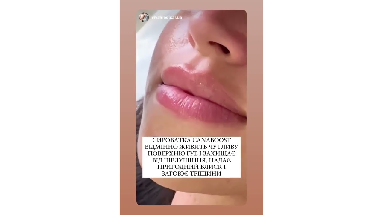 Dermadrop - безиньекционная мезотерапия в клинике Vivamedical Aesthetic Club