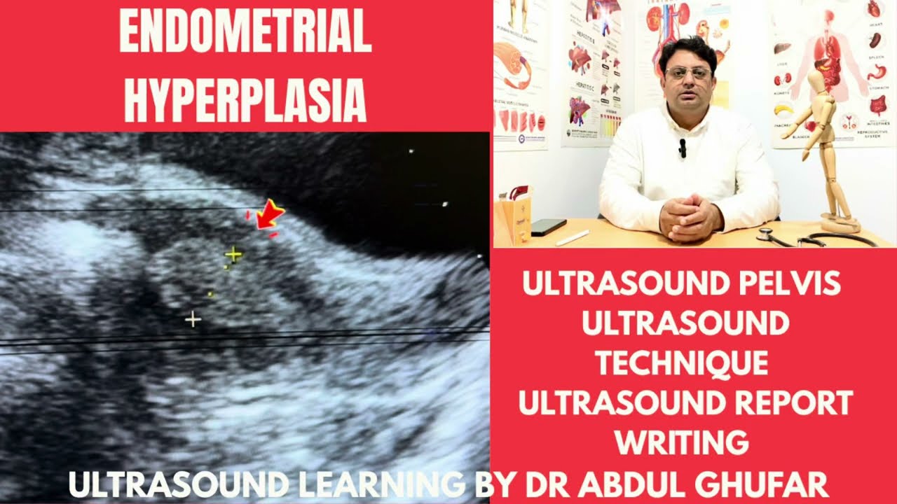 Endometrial hyperplasia | uterus ultrasound | uterine hyperplasia | uterus ultrasound report | uteru