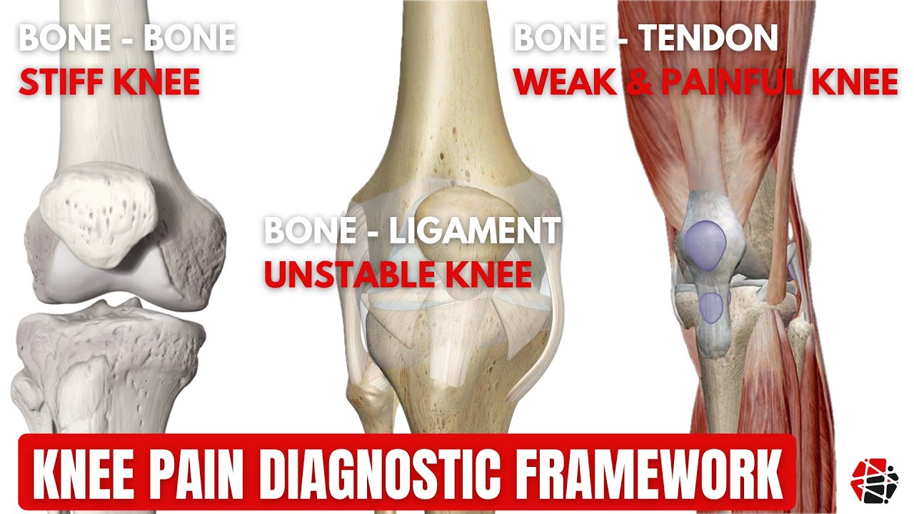 Knee joint diagnostic framework #physiotherapist #kneepain