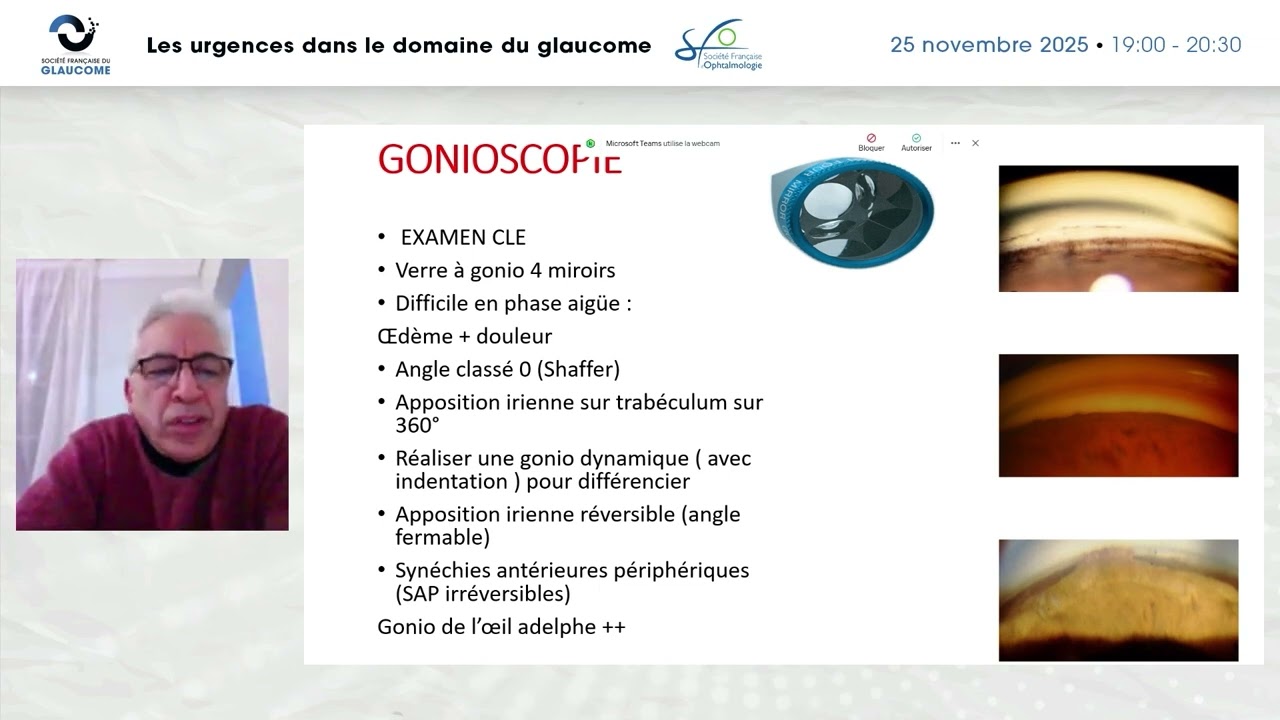 2025 11 25 01 ABERKANE: Crise aigüe de fermeture de l’angle
