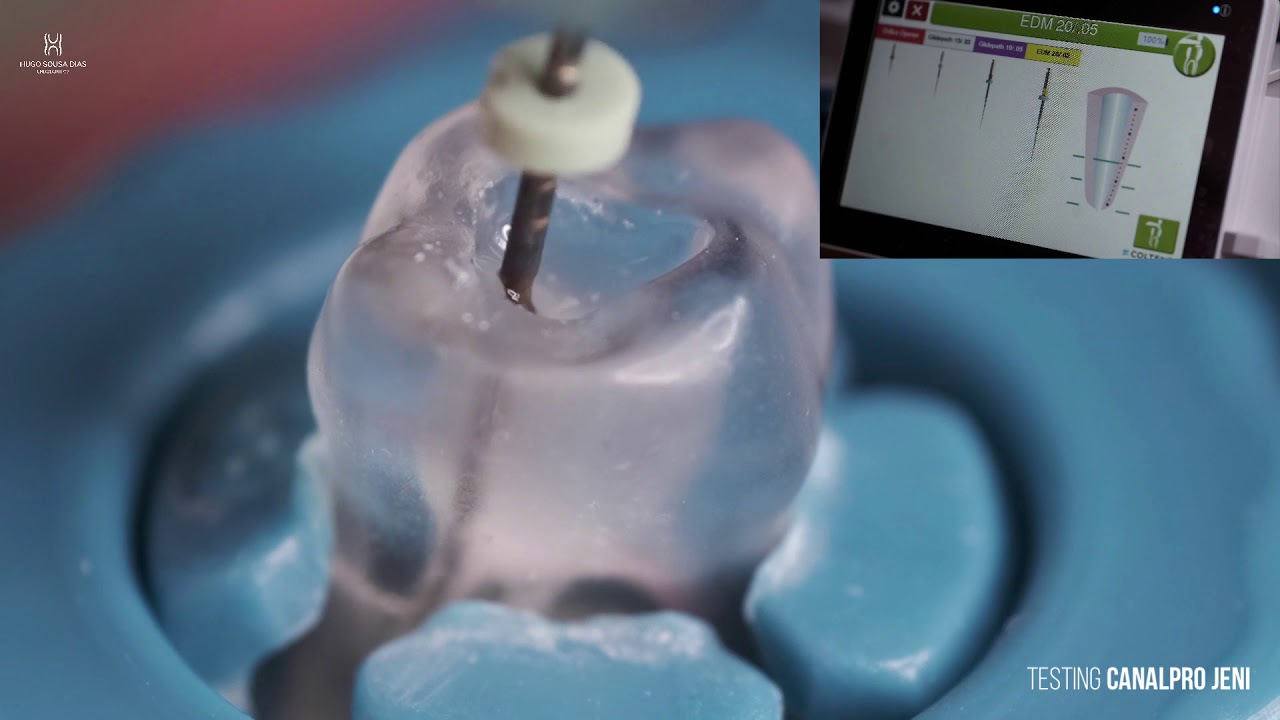 CANALPRO JENI (Endo Motor) testing