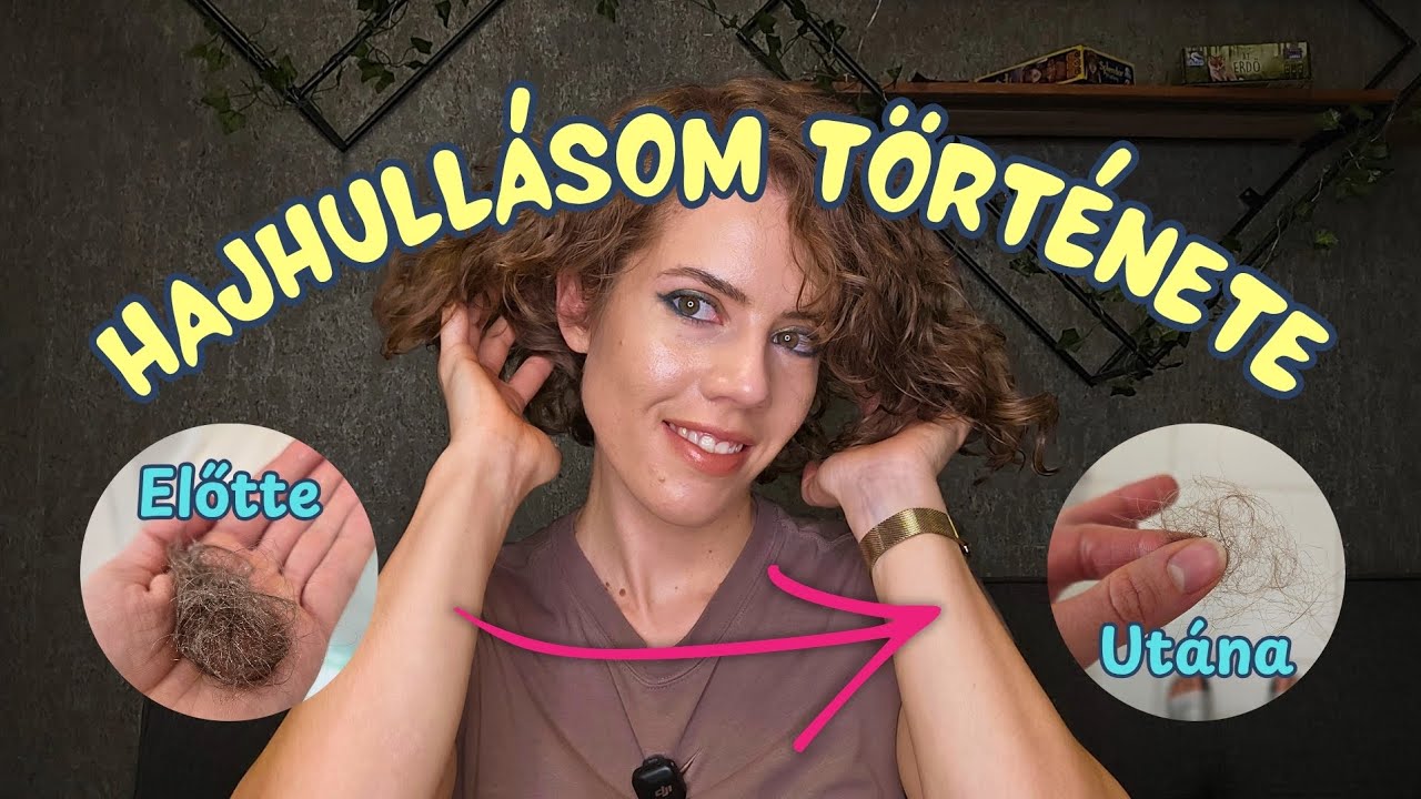 Hajhullás STORYTIME | Okok a hajhullás mögött | Termékajánlóval