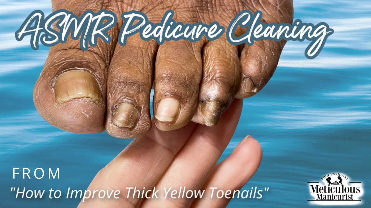 👣ASMR Pedicure Cleaning💆&zwj;♀️How to Improve Thick Yellow Toenails👣