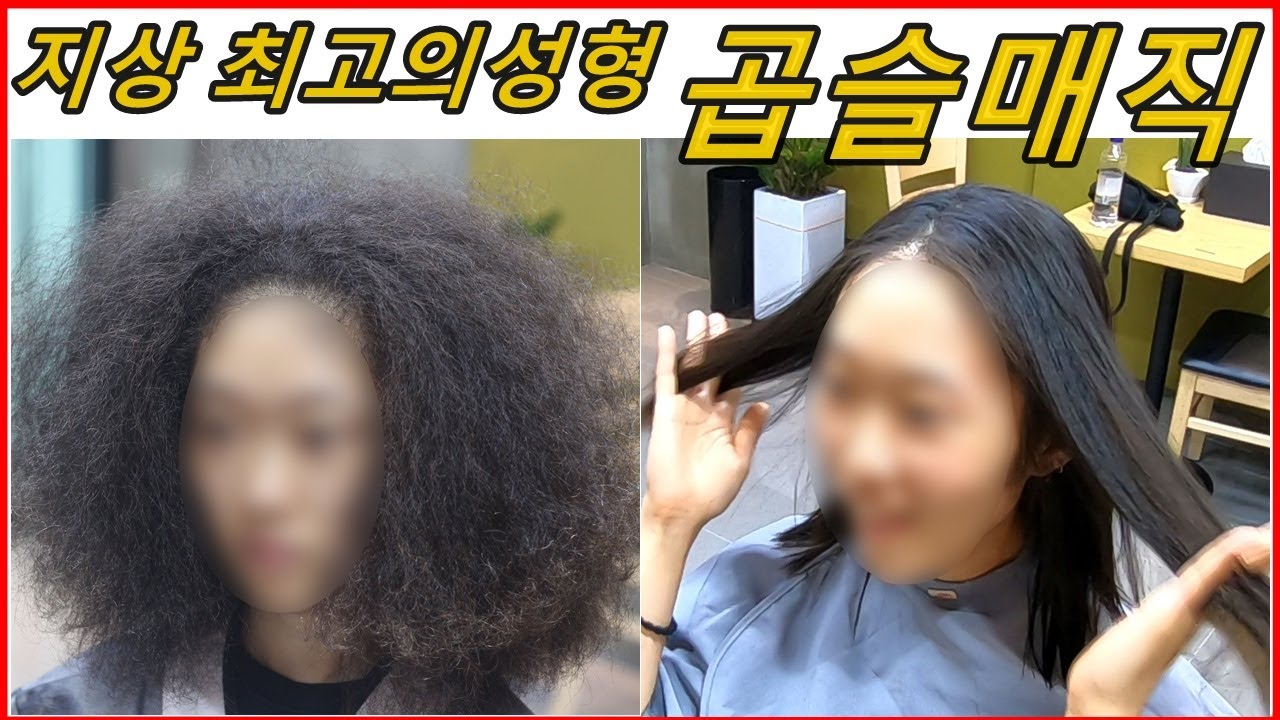 반박불가 최고 아름다운 성형 