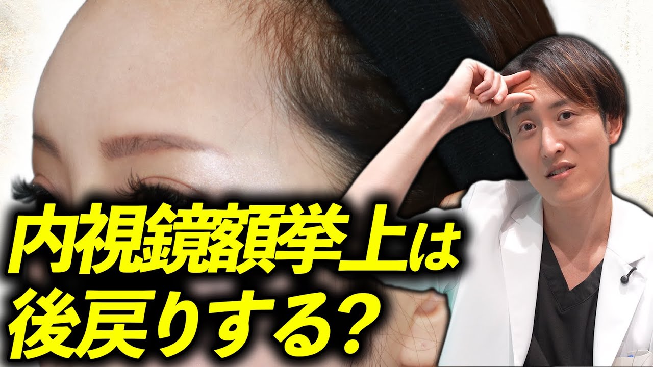 内視鏡額挙上は目が大きくなる！？全部答えます【前額リフト】