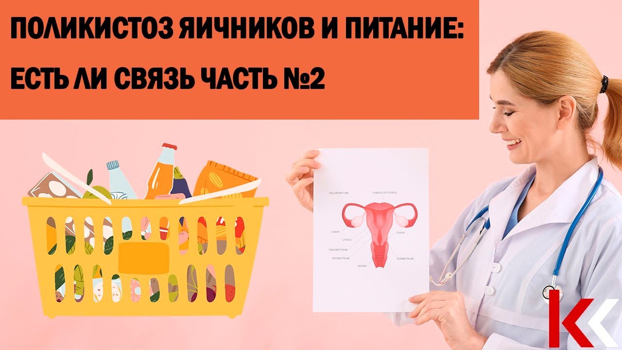 Поликистоз яичников и питание: есть ли связь? Часть 2.