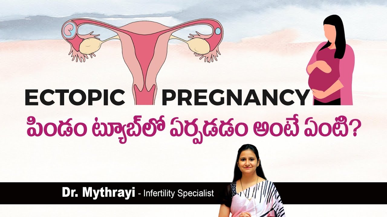 ఎక్టోపిక్ ప్రెగ్నెన్సీ అంటే ఏంటి | What is Ectopic Pregnancy in Telugu | Mythri Sri Fertility Centre