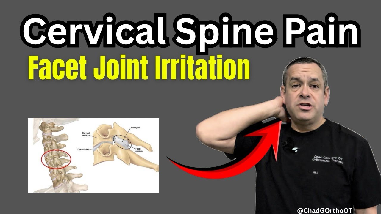 Cervical Facet Syndrome | Neck Pain, Stiffness & Treatment Options