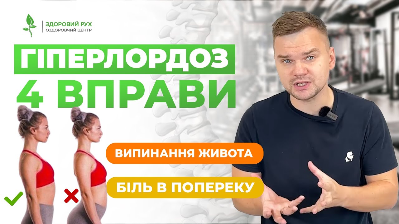 КОМПЛЕКС ВІД ГІПЕРЛОРДОЗУ для ЗДОРОВОЇ ПОСТАВИ! 4 дієві вправи при гіперлордозі |Кінезітерапія