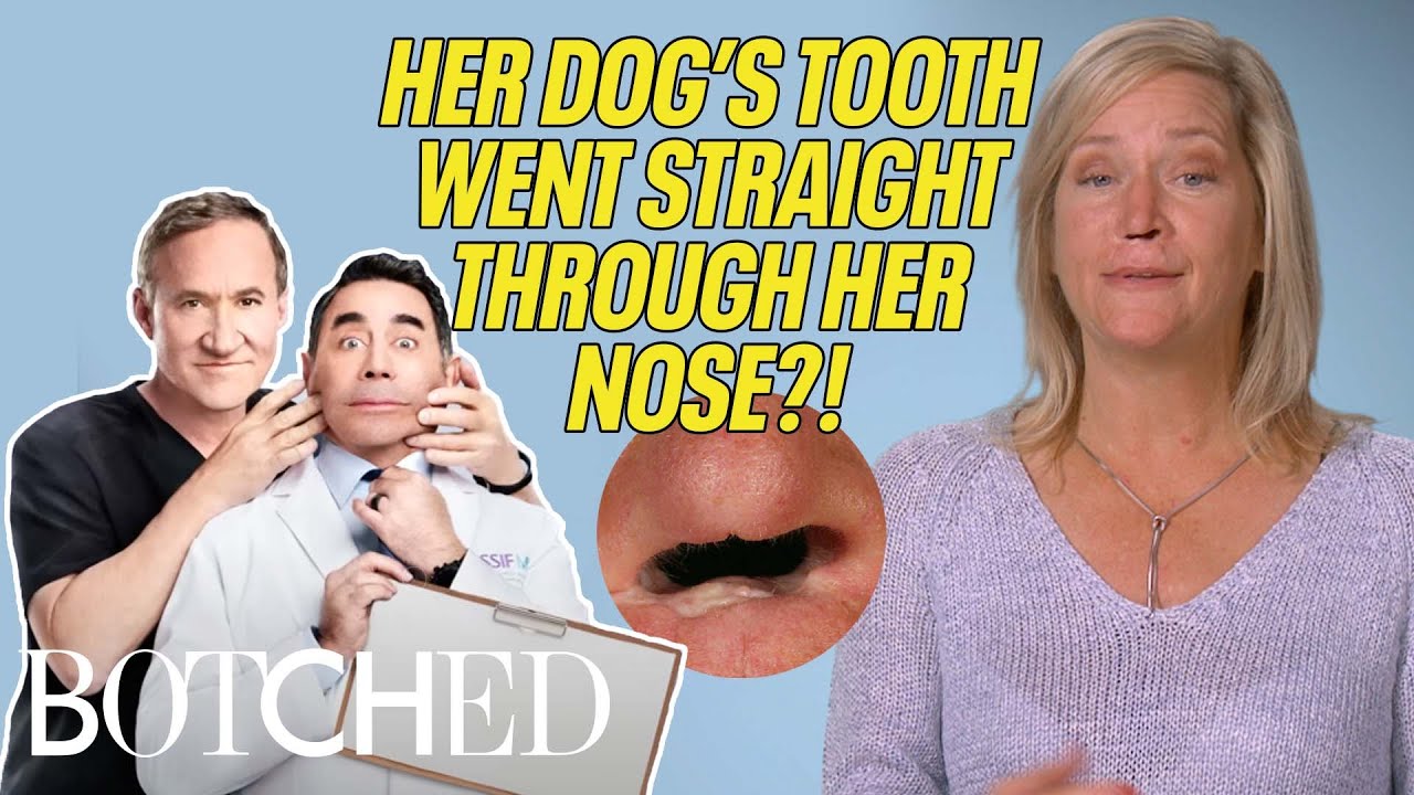 Laura is MISSING the Center Part of Her Nose?! | Botched | E!