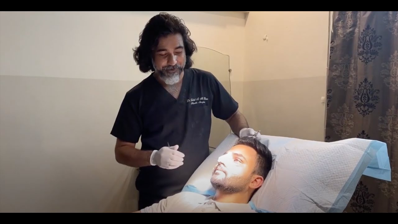 Rhinoplasty reveal another Happy Patient :)