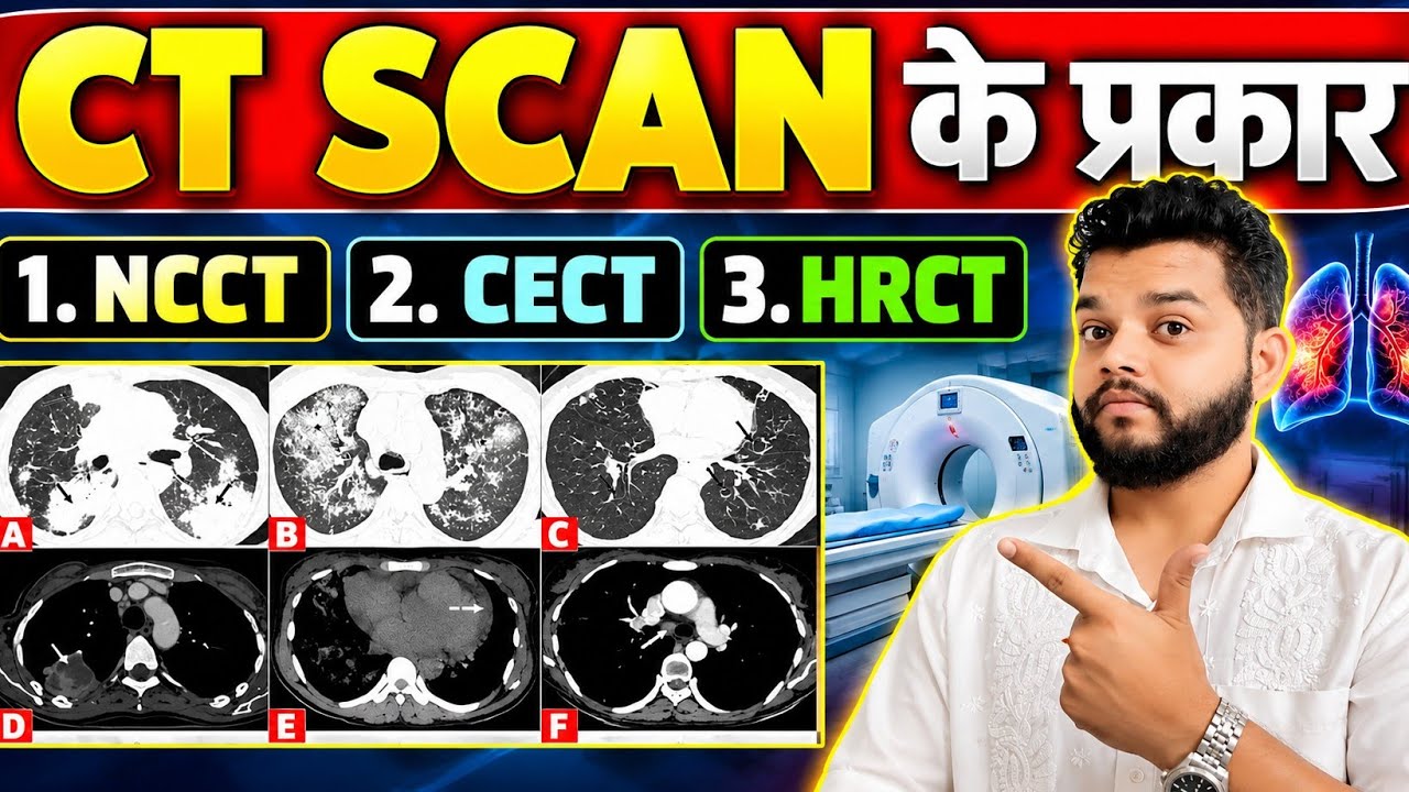 Types Of CT Scan In Hindi | CECT,NCCT & HRCT को समझिए क्या अंतर है