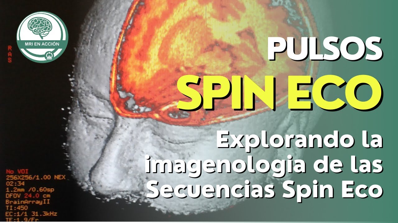 SPIN ECO - Explorando la imagenologia de las Secuencias Spin Eco (1/2)