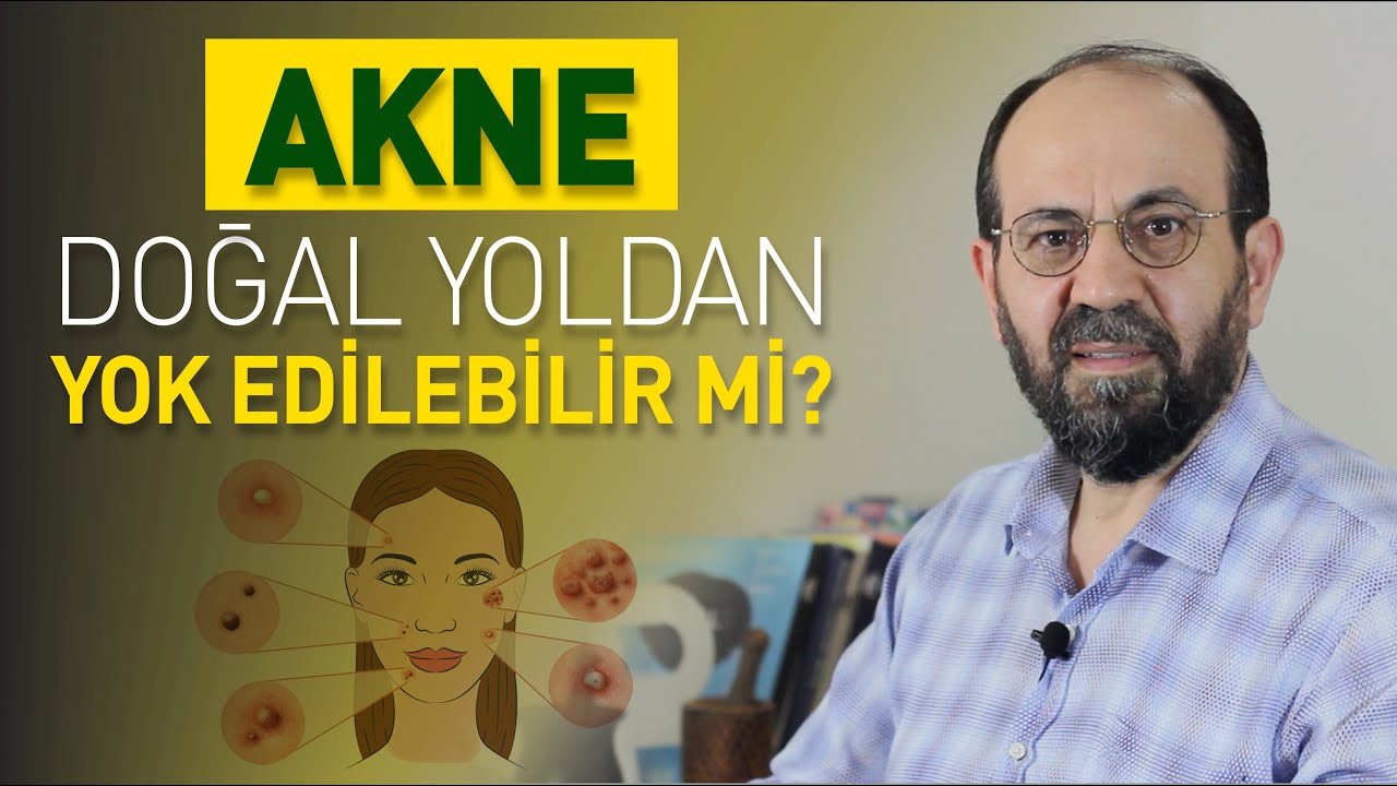AKNE DOĞAL YOLDAN YOK EDİLEBİLİR Mİ?