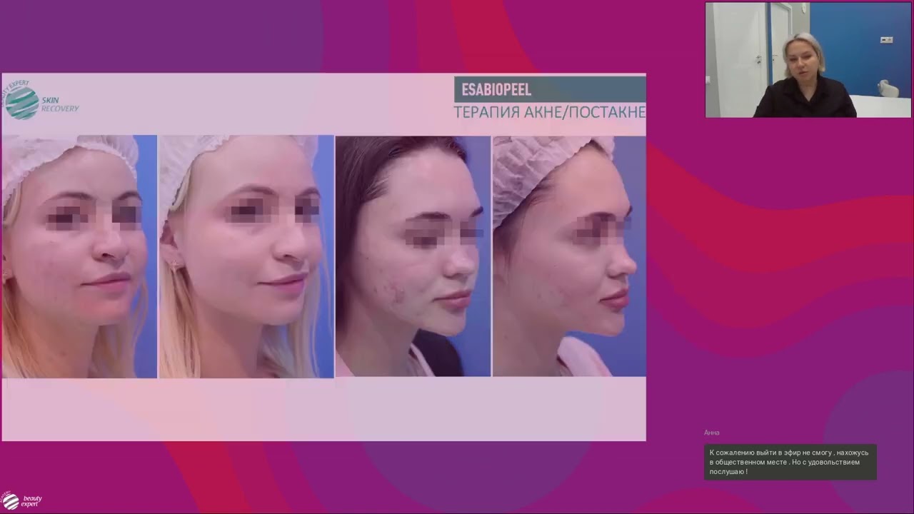 Запись вебинара: Система биоревитализирующих итальянских пилингов Aesthetical
