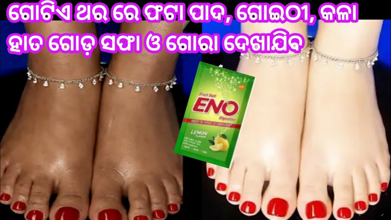କେବଳ ଗୋଟିଏ ଥର ରେ ଗୋରା ଦେଖାଯିବ ଓ ଠିକ୍ ହେବ ଫଟା ପାଦ, ଗୋଇଠୀ ଦରଜ😱 ଜବରଦସ୍ତ ଉପାୟ।odiakitchentips।crackheel 