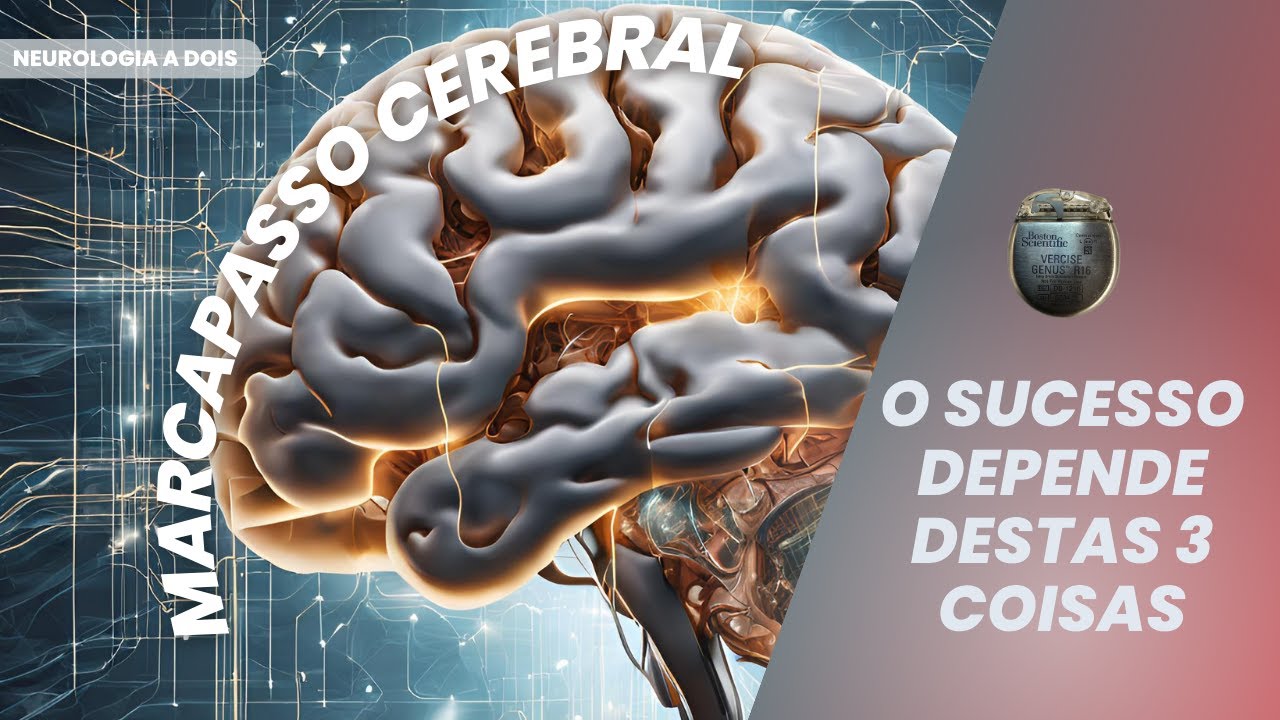 3 COISAS QUE PRECISAM DAR CERTO NA CIRURGIA DE MARCAPASSO CEREBRAL.