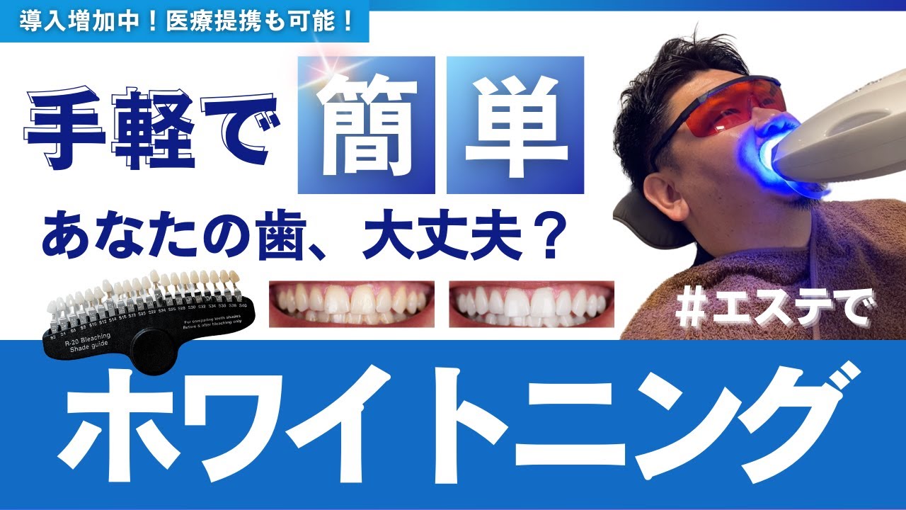 【ヘアサロン必見】ホワイトニング機器をサロンが導入するメリット