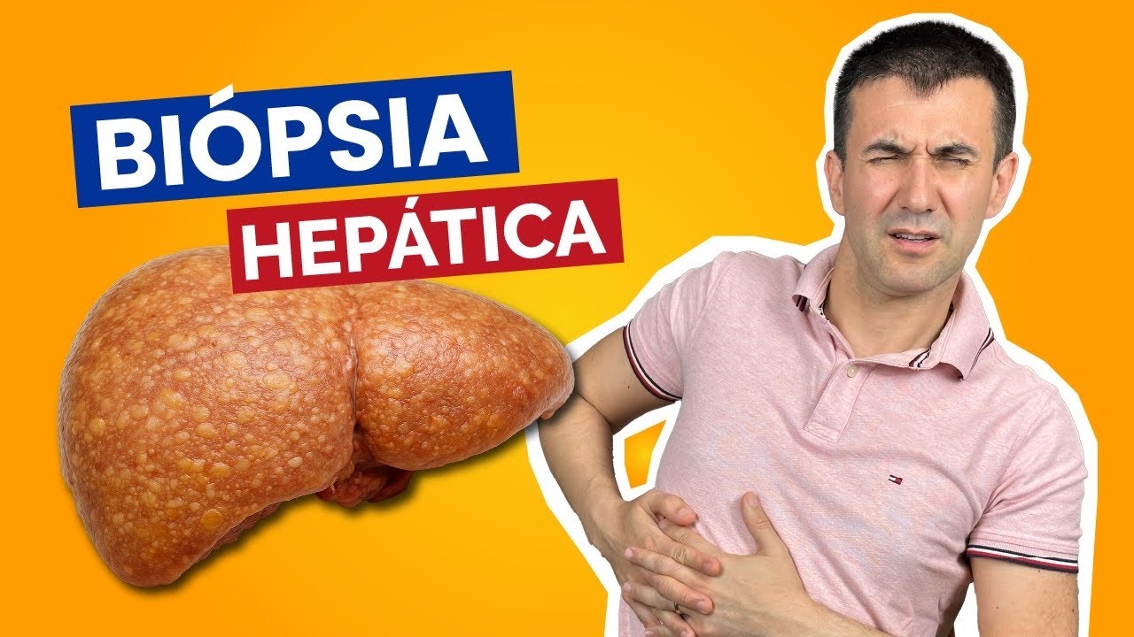 Biópsia no fígado gorduroso: quando é necessária?