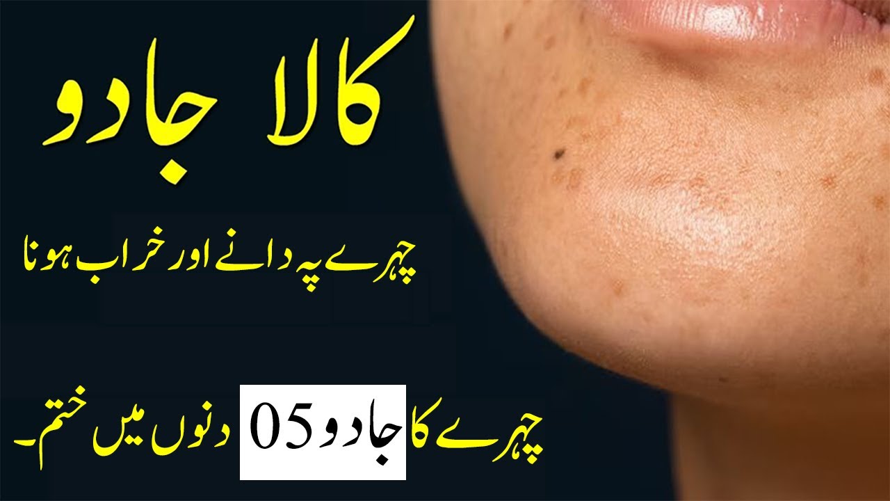 Kala Jadu (Chehre pe Dany aur Jadu 05 Dinu mai Khatam hoga)