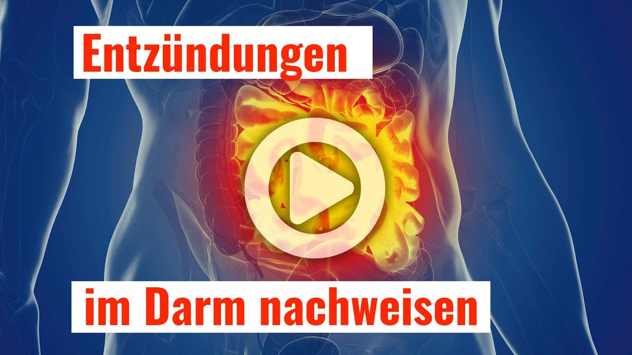 Entz&uuml;ndungen im Darm nachweisen mit einem einfachen Stuhltest