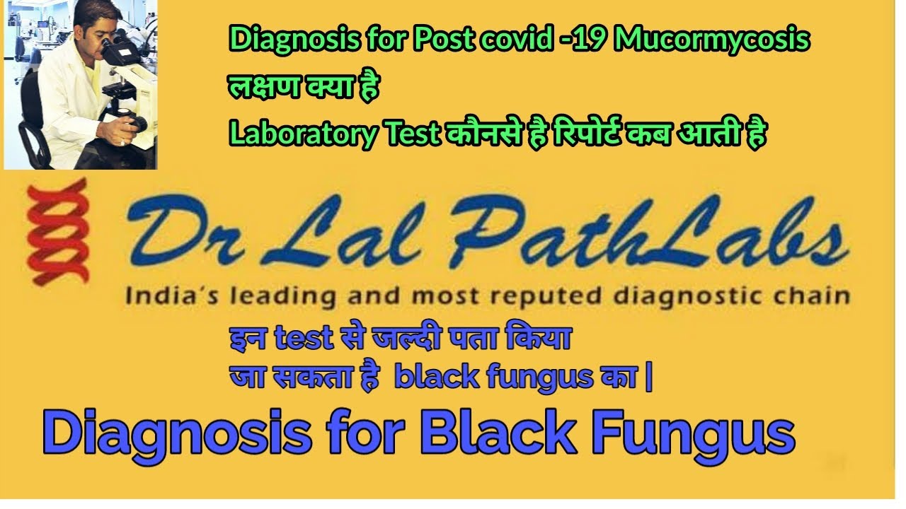 Diagnosis for black Fungus| Diagnosis for Post Covid -19 Mucormycosis | Lab Test for Black Fungus |