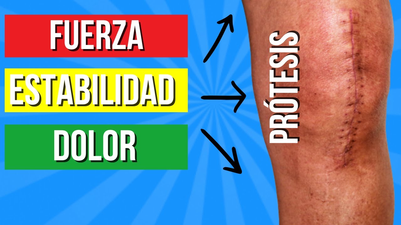Cómo Saber Si Estoy Bien Recuperado/a de una PRÓTESIS de RODILLA | Haz estas 5 PRUEBAS Caseras