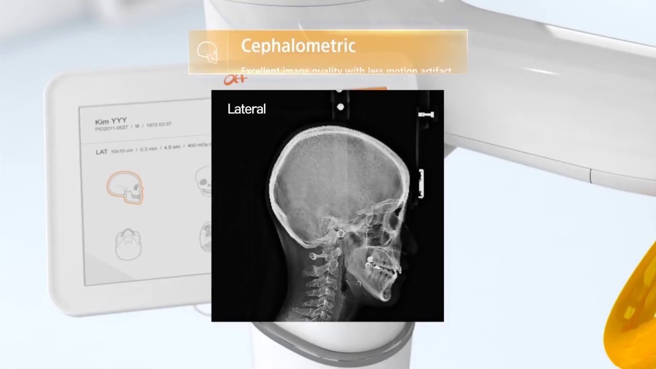Cephalometric PA Acquisition Tutorial