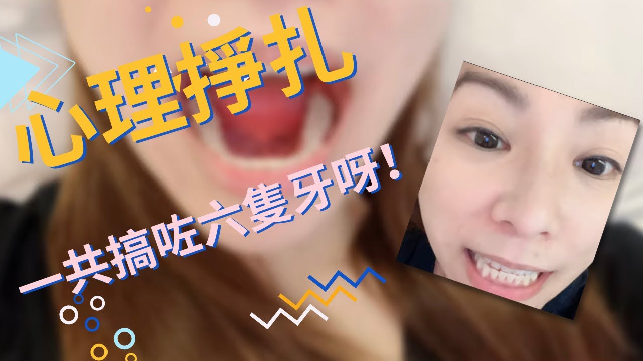 【遊】泰國🇹🇭之旅： 🦷🦷牙齒  補左6隻牙呀！      MoMo UK 英國🇬🇧日常  VLOG
