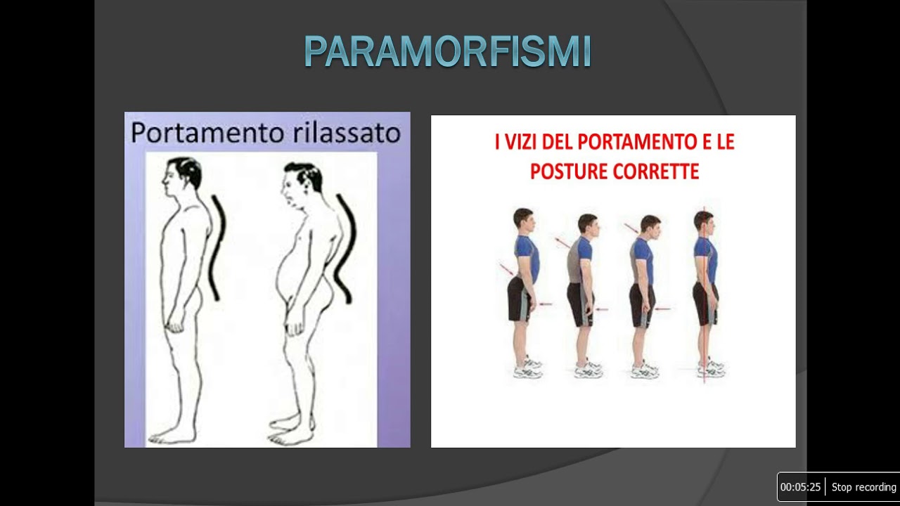 paramorfismi e dismorfismi