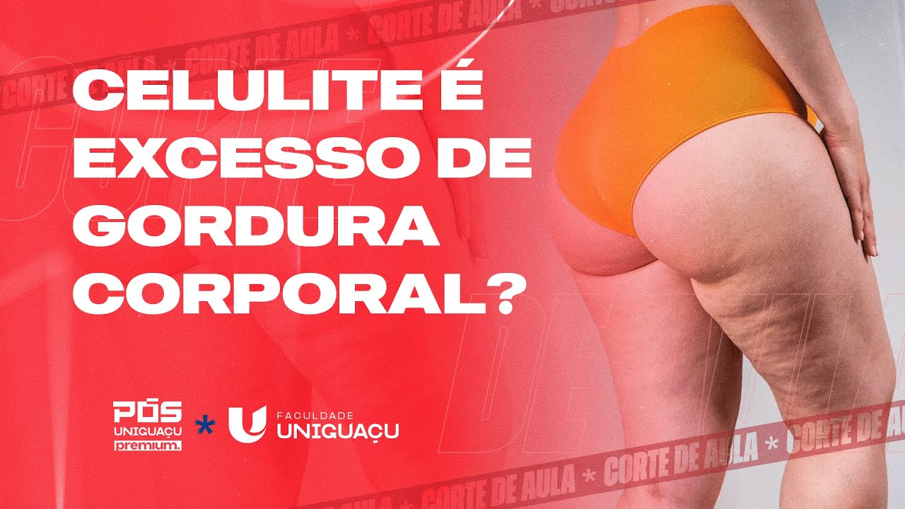 Celulite: Genética, Gordura Corporal e Hormônios — O que REALMENTE Influencia – Dra. Aline David