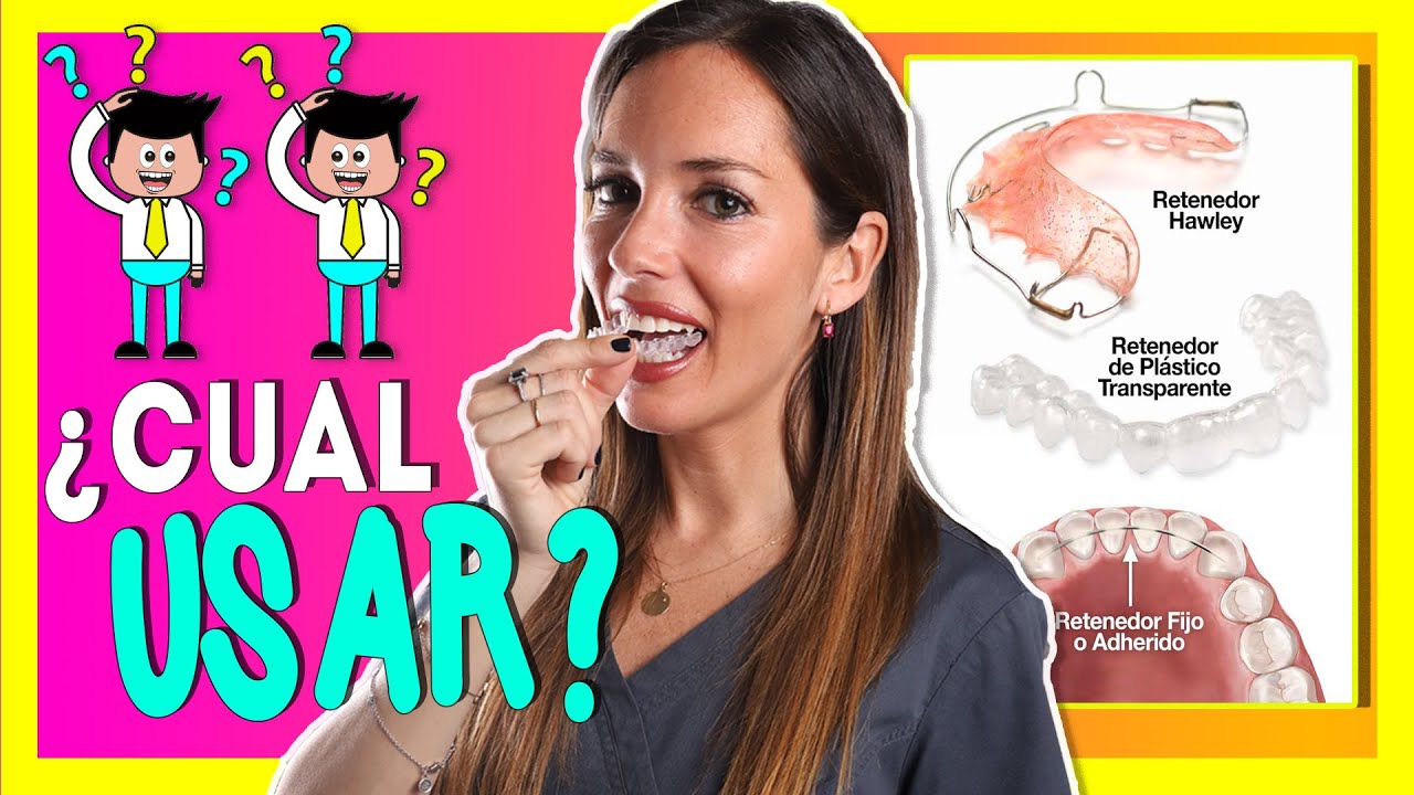 🤷&zwj;♂️&iquest;DESPUES de  LOS BRACKETS los dientes se MUEVEN? ✅𝑹𝑬𝑻𝑬𝑵𝑬𝑫𝑶𝑹𝑬𝑺 fijos y removibles en ORTODONCIA
