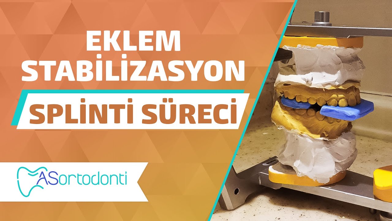 Eklem Stabilizasyon Splinti Süreci | AS Ortodonti