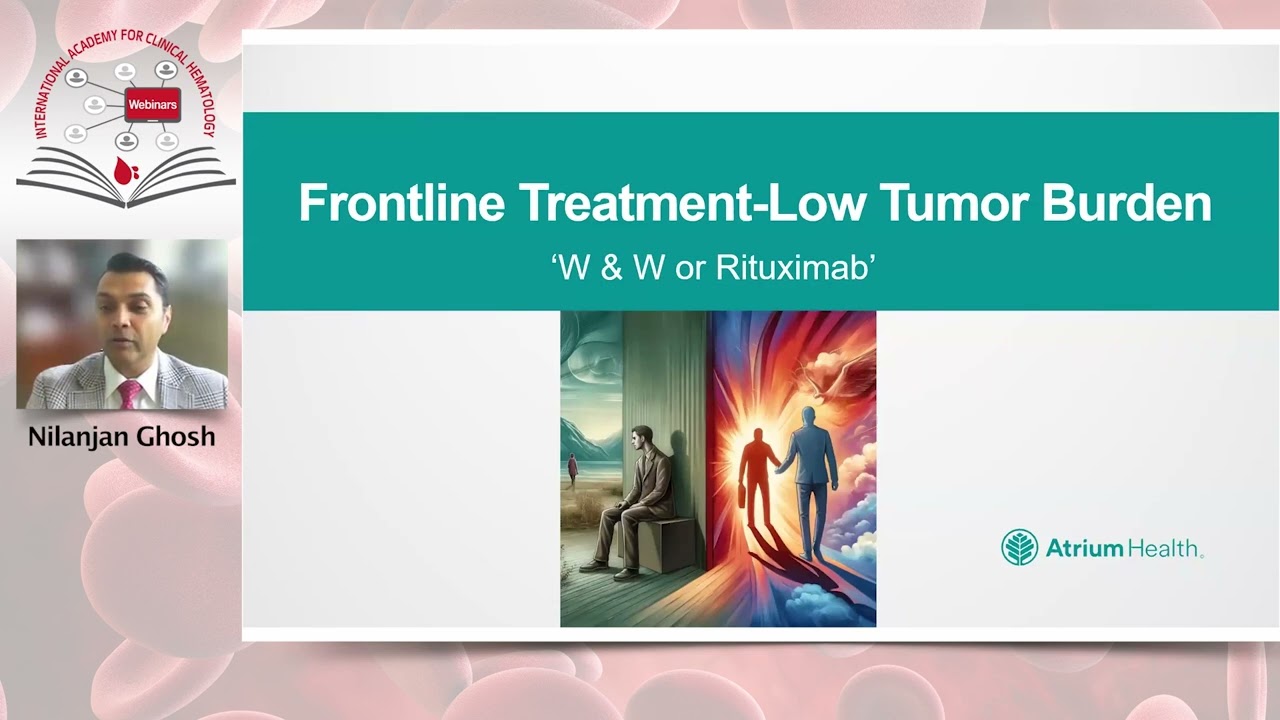 State of the Art Management of Follicular Lymphoma