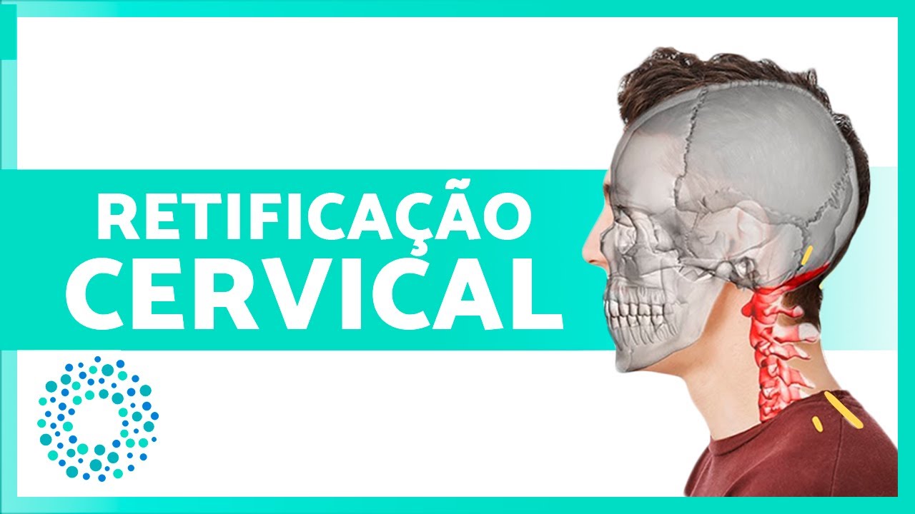 Os 3️⃣ MELHORES EXERCÍCIOS para a RETIFICAÇÃO CERVICAL 🧣