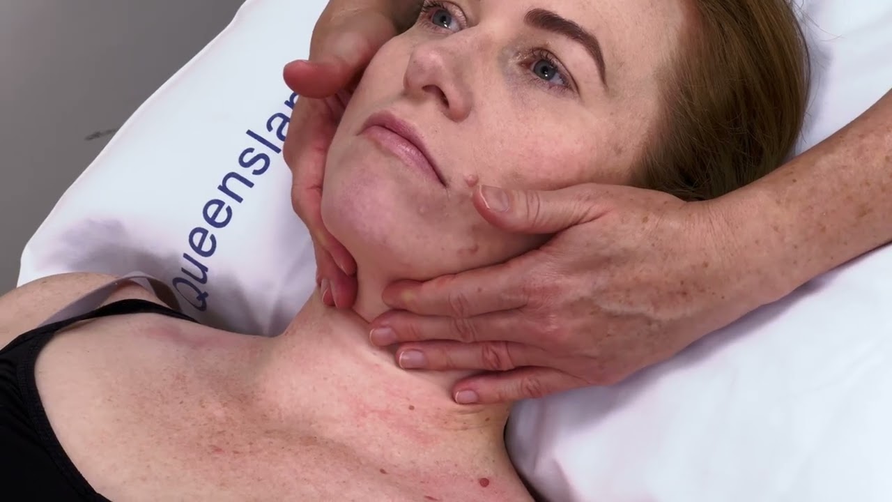 Как выполнять массаж при лимфедеме, вызванной раком головы и шеи