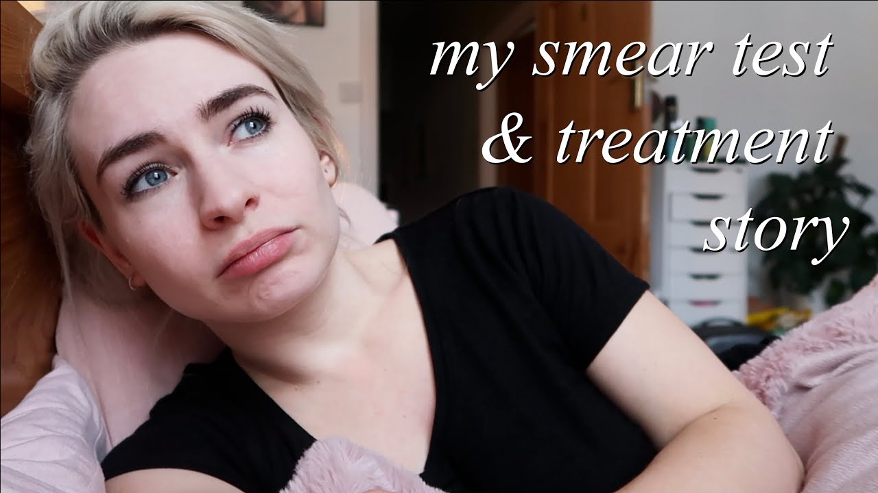 GOING TO MY SMEAR TEST + MY ABNORMAL CELLS STORY