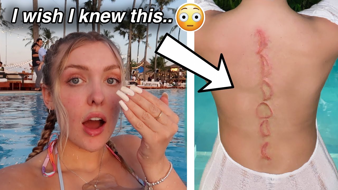 I got the CHEAPEST henna tattoo in Bali *ALLERGIC REACTION*