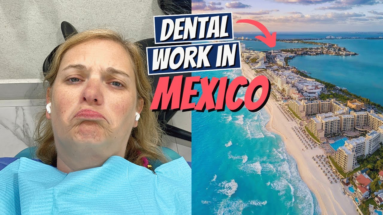 I Went to MEXICO for Dental Work!!! (PRICES + RESULTS)