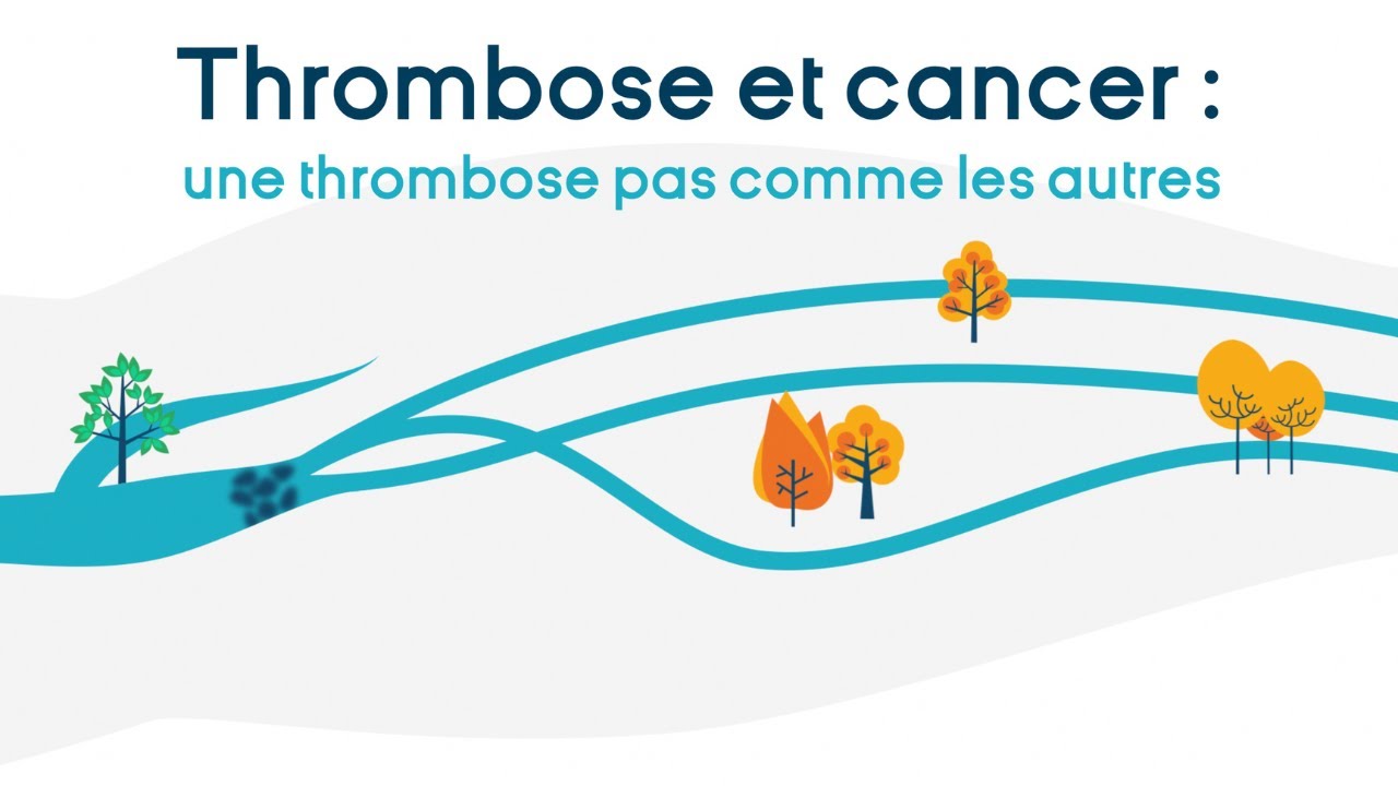 [Thrombose et cancer] Vidéo Patients - Version intégrale