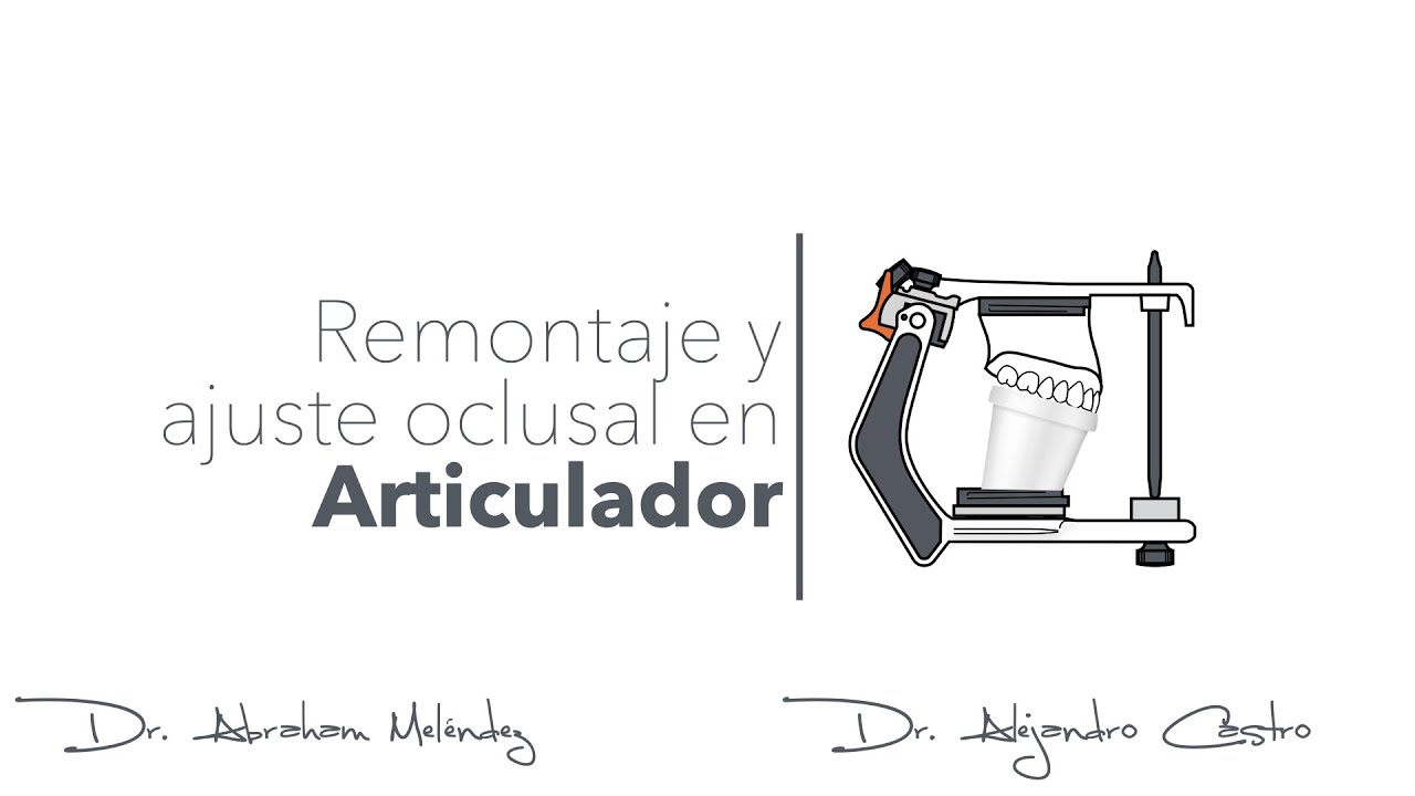 Remontaje en Articulador