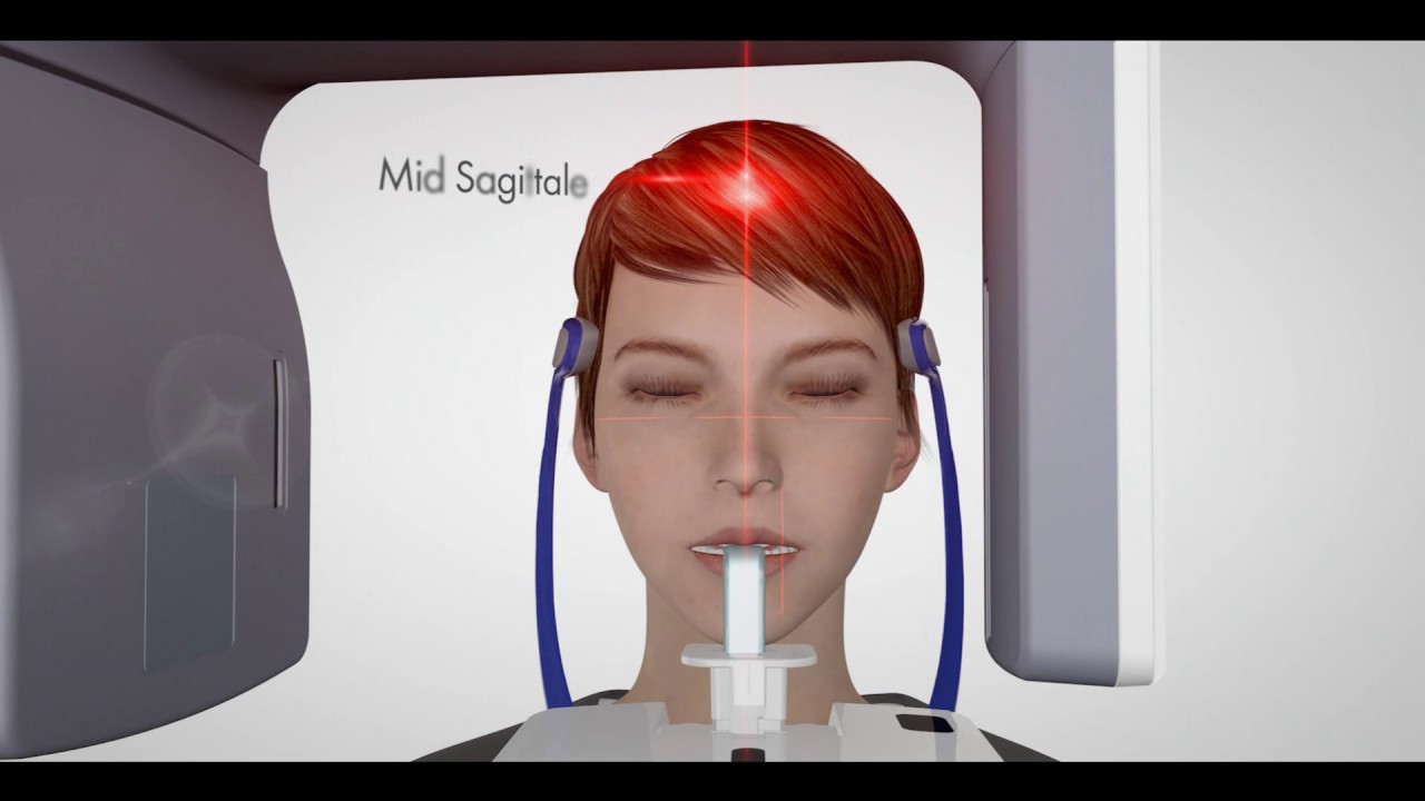 VistaPano S Ceph positioning video - Dürr Dental