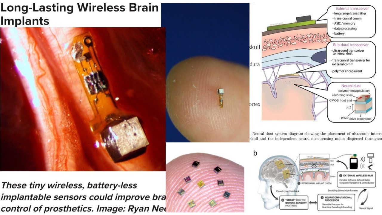 DARPA N3 & Neural Dust: Control of Brain & Organs w/ Nanotech, Ultrasound & Piezoelectric Crystals