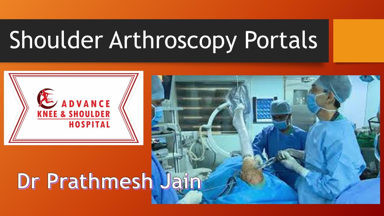 Shoulder arthroscopy Position and Portals for Training of Orthopedic Surgeons