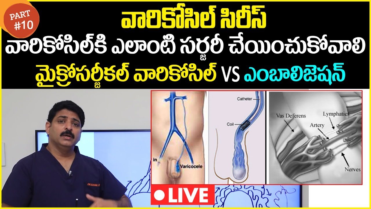 ఏ సర్జరీ చేయించుకోవాలి | Embolization Vs Micro Surgery For Varicocele | Dr Rahul Reddy | Androcare